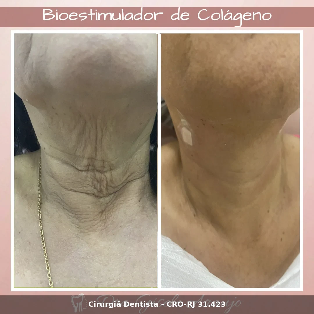 Harmonização Facial — Dra. Gisele Araujo