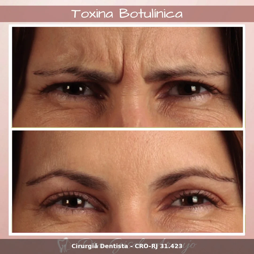 Harmonização Facial — Dra. Gisele Araujo