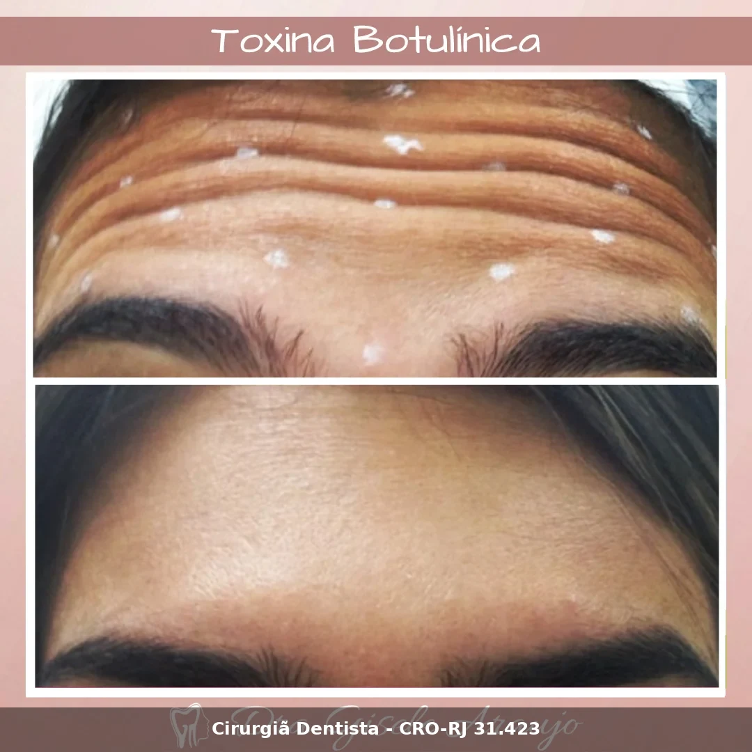 Harmonização Facial — Dra. Gisele Araujo