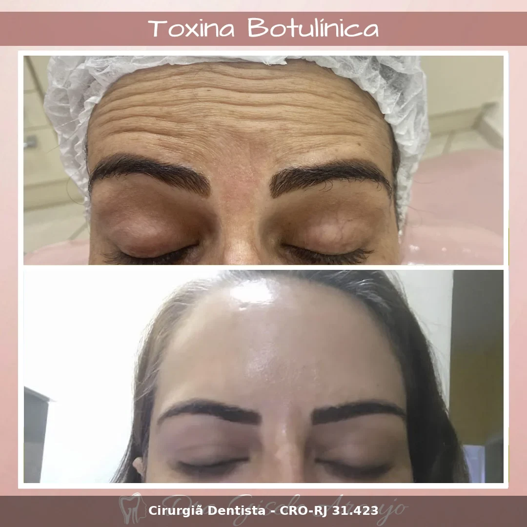 Harmonização Facial — Dra. Gisele Araujo
