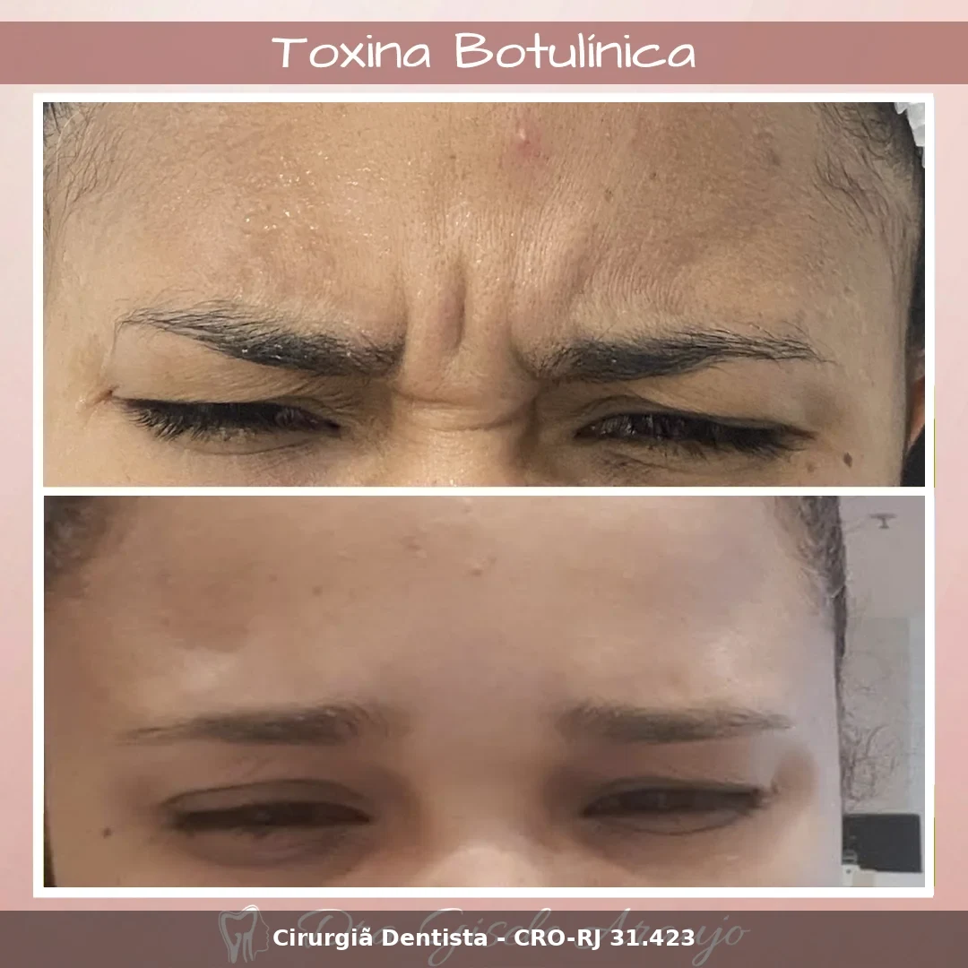 Harmonização Facial — Dra. Gisele Araujo