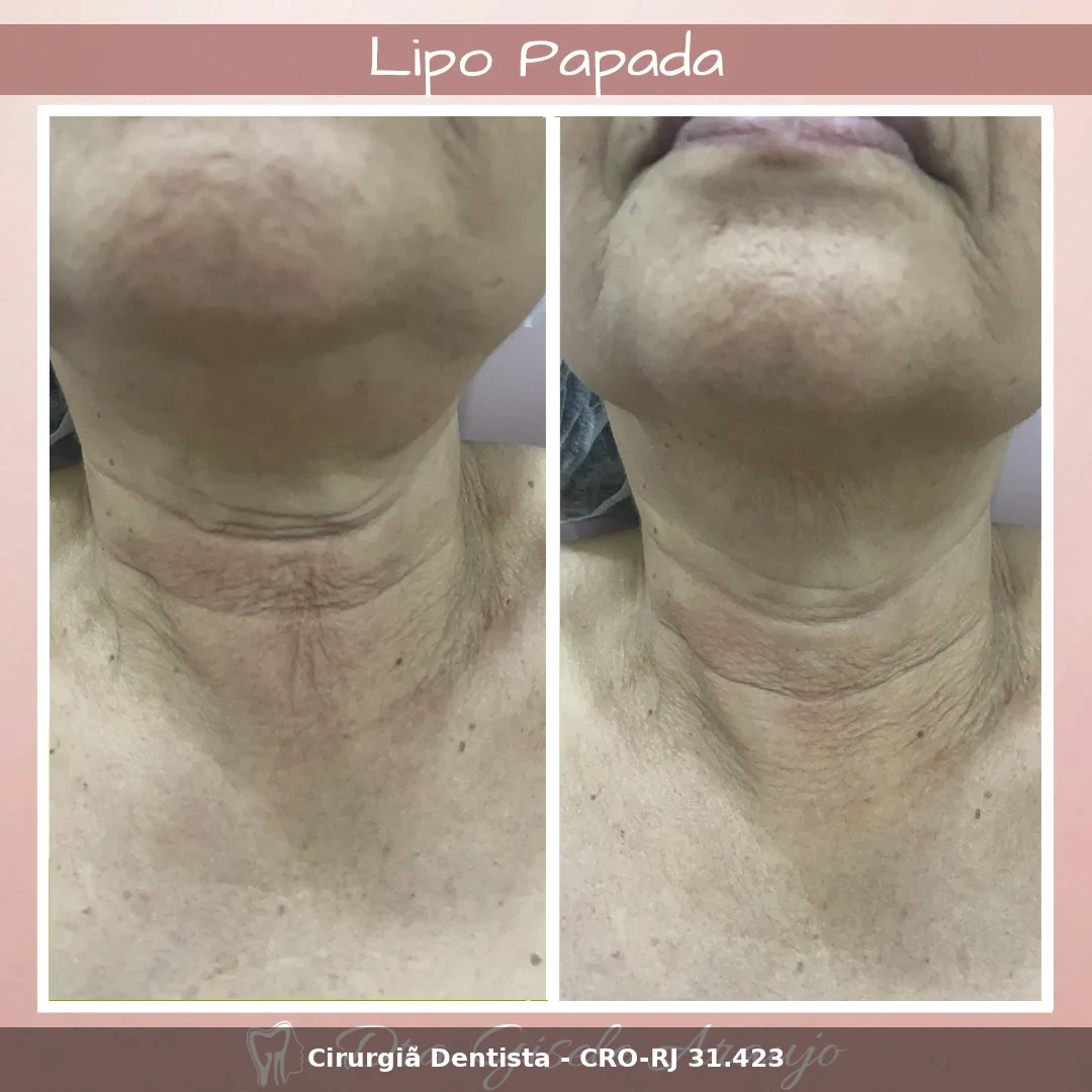Harmonização Facial — Dra. Gisele Araujo
