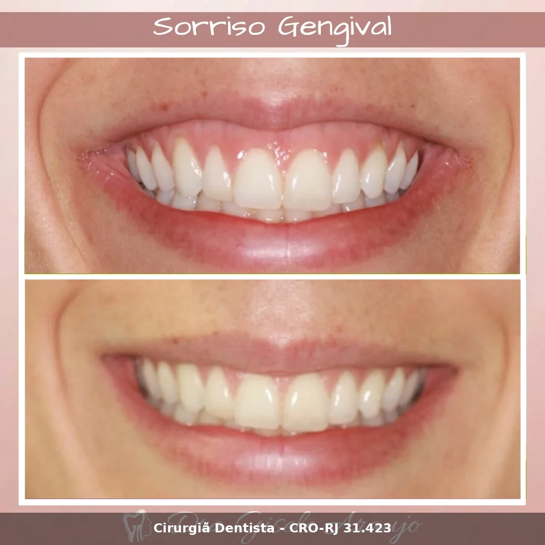 Harmonização Facial — Dra. Gisele Araujo