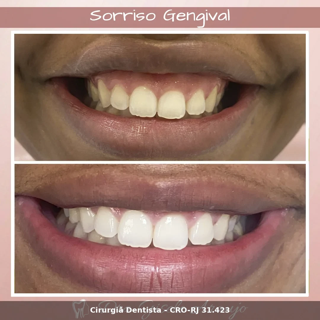 Harmonização Facial — Dra. Gisele Araujo